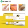 ZOVAMUSE Bee Venom Wart Corn & Callus Remover Cream