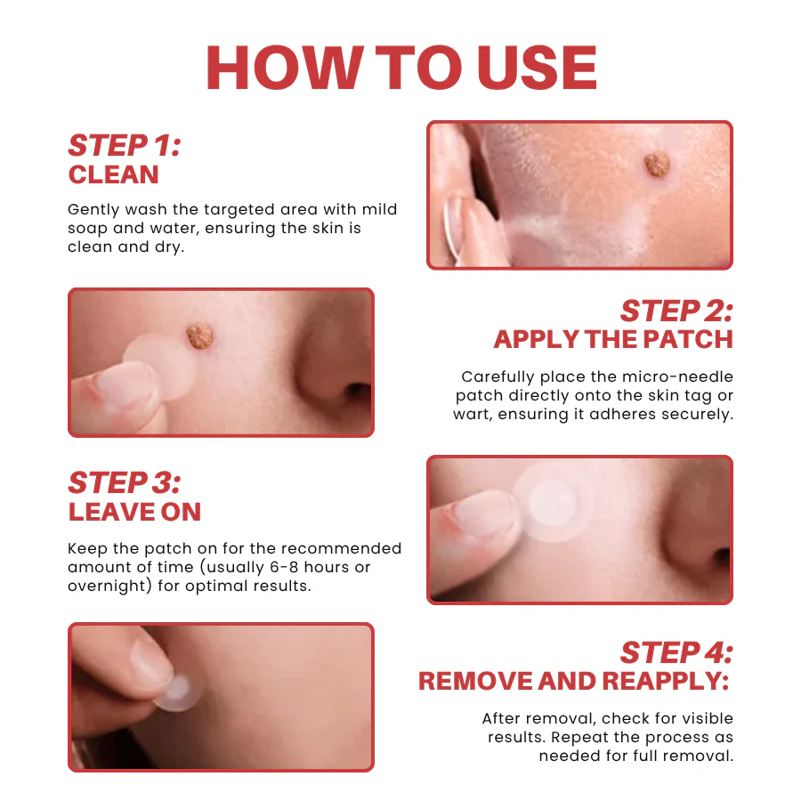 250716 Fivfivgo MicroNeedleBotanicSkinTagRemovalPatch Img6