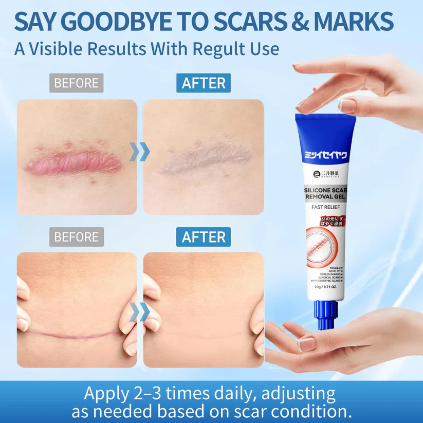 Alisanda Scar Repair Cream|Treats Old and New Scars, Burns and More