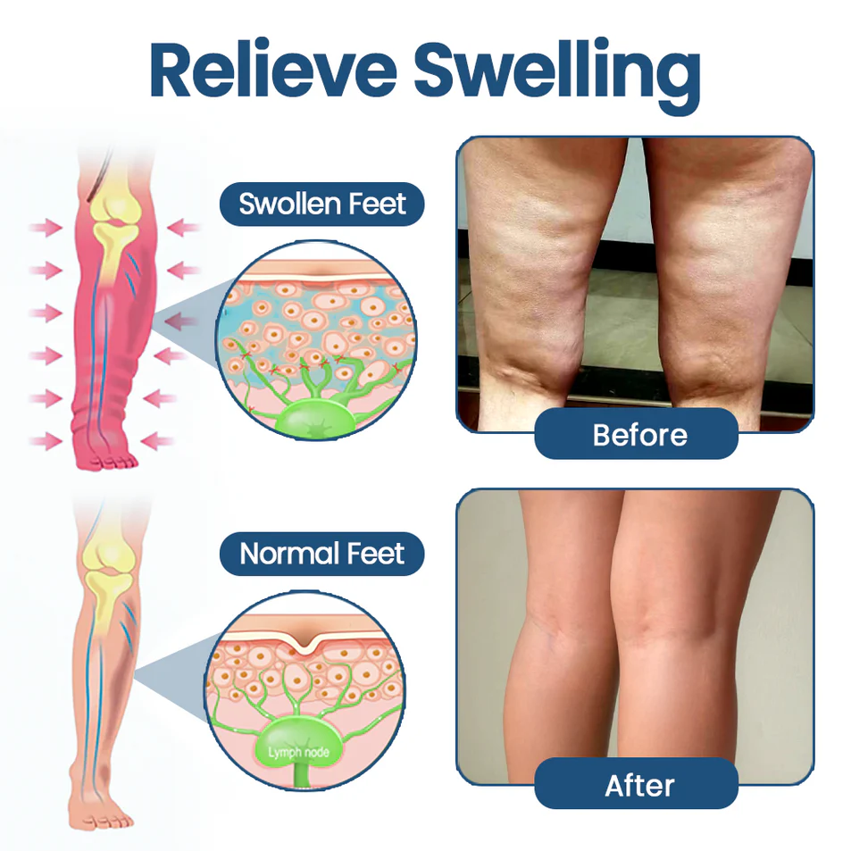 KUBOZN® Roll-On Cream for Lymphatic Drainage & Swelling Relief